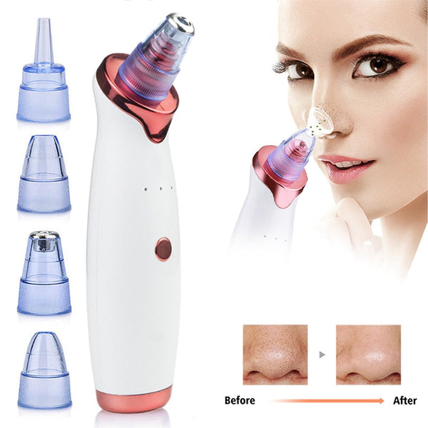 Electric Vacuum Facial Blackhead Remover - Ebz Beauty and Phyzique